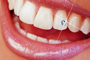 67% попуст на апликација на забен циркон во стоматолошка ординација КИМДЕНТ во вредност од 1000ден. за само 330ден.