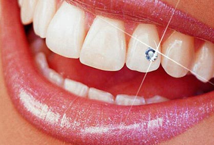 67% попуст на апликација на забен циркон во стоматолошка ординација КИМДЕНТ во вредност од 1000ден. за само 330ден.